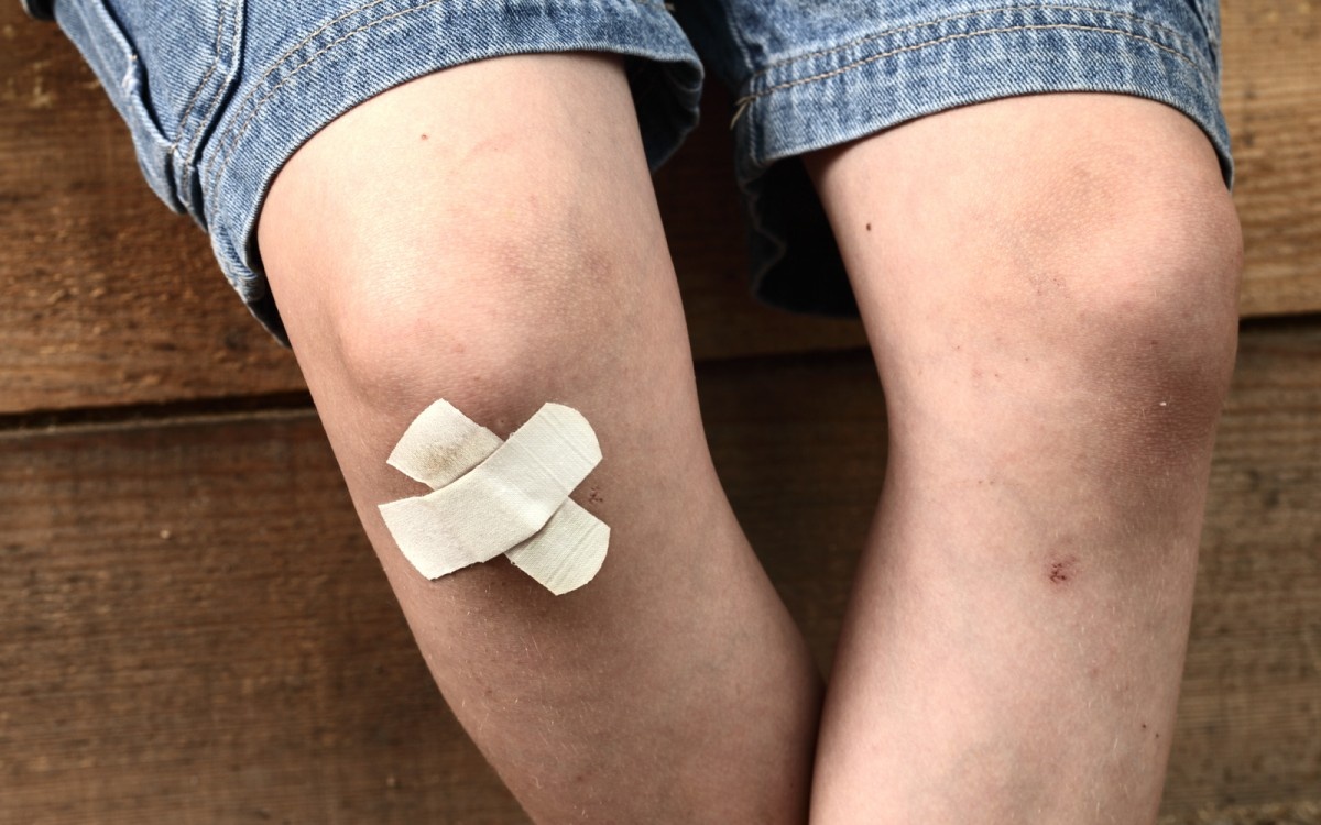 Kolena otroka, na enem kolenu sta nalepljena dva obliža.